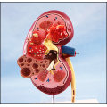 PVC Human Kidney Anatomical Model for Sale